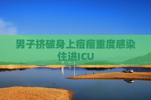 男子挤破身上痘痘重度感染住进ICU