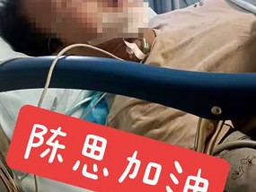 三年挣百万的外卖骑手发生车祸，身边人士：骨折，需静养